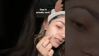 Thumbnail: Best pimple patch in India🤌🏻🫶🏻 | AMULYA RATTAN