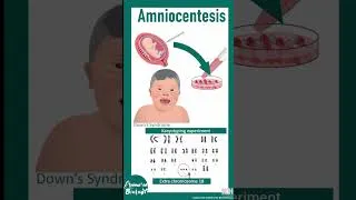 Thumbnail: Amniocentesis | Why Do Doctors Do Amniocentesis ? |  #animated_biology #bio_facts