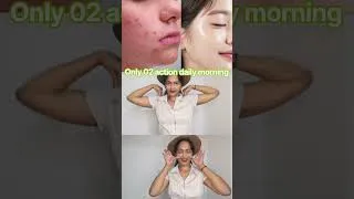 Thumbnail: Attractive face Exercise for women 🥳!