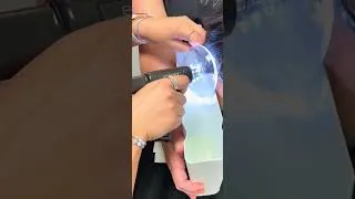 Thumbnail: Earwax removal with Earigator #earwaxcleaning #earwaxremoval #audiology