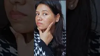 Thumbnail: झाइयां pigmentation हटाने का कमाल का तरीका #homeremedy #pigmentation #shorts