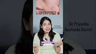 Thumbnail: Open Pores in Monsoon? Here's What to do! #openporesremedy#skincare# #glownaturally#skincareroutine
