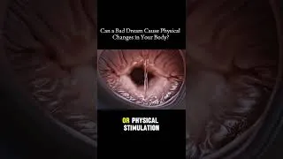Thumbnail: #animation #viral #pregnancy