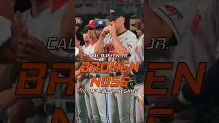 Thumbnail: A Photo Shoot Almost Ended Cal Ripken Jr.'s Iron Man Streak! 😧👃🏼🩸