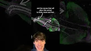 Thumbnail: Fish Embryo Neurogenesis #shorts