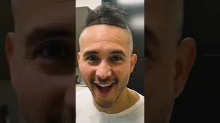 Thumbnail: This is Year 2. SLY: A Hair Transplant Story