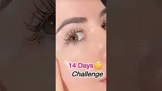 Thumbnail: 14 Days Challenge For Korean Glass Skin😳💥