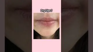 Thumbnail: Vaseline Rose Lip balm 💗 #lipboss #lipbalm #vaseline #glowup2026 #shorts