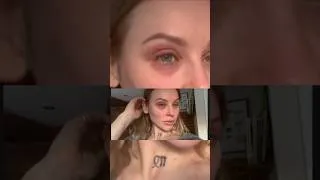 Thumbnail: Breast Implant Illness Is Real