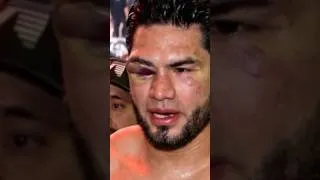 Thumbnail: David Benavidez win over Zurdo 🥇 accident elbow mattered? #mexican #boxing #zurdo #benavidez