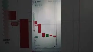 Thumbnail: Binary Options Trading: My High Accuracy Non-Repaint Setup 🎯
