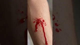 Thumbnail: How to stop blood clots #shorts #trending