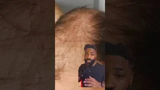 Thumbnail: First sign you’re losing hair for your hair type | Brotherly Hairloss Tips (4/30)