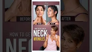 Thumbnail: Your Neck Is Aging From the SIDES! Try This Massage