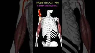 Thumbnail: Fix Pain at the Front of your Shoulder