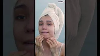 Thumbnail: Hydroquinone Cream, Hydroquinone Cream Side Effects | Boldsky