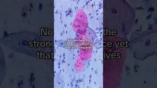 Thumbnail: Amazing Cervical Cancer News! 💙