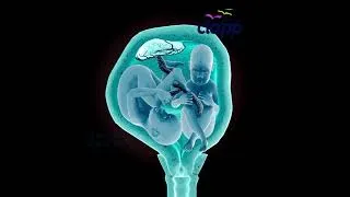 Thumbnail: Twins Kicking Inside the Womb! Watch This Amazing Moment Before Birth 🤰 #Shorts (part 2)