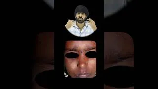 Thumbnail: White Spot on Face