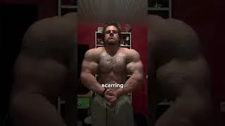 Thumbnail: One of the most 20yr Old Jacked