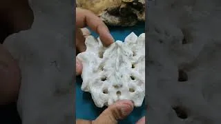 Thumbnail: Structures emerging through sacral hiatus