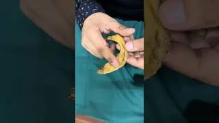 Thumbnail: first rib part-2