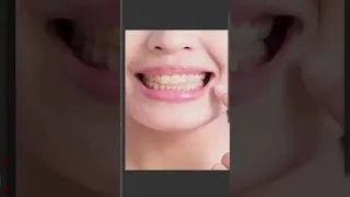 Thumbnail: Whiten Teeth Easily - Photoshop Tutorial  #shorts #photoshoptutorial