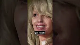 Thumbnail: My Facebook Stalker Threw Acid in my Face