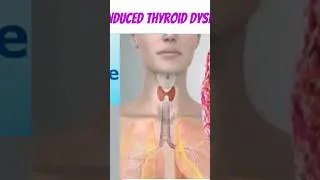 Thumbnail: #AmiodaroneInducedThyroidToxicity #ThyroidToxicity #MedicineInsights #HealthcareEducation #Medical