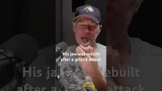 Thumbnail: His jaw was rebuilt after a grizzly attack￼