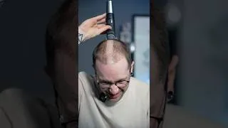 Thumbnail: I Deleted My Hair…