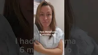 Thumbnail: Melanoma free
