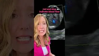 Thumbnail: How We Check a Baby’s Heart at 20 Weeks 💓