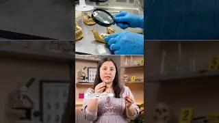 Thumbnail: Rugoscopy, a hidden forensic tool #rugoscopy #forensicscience #forensicfacts #dikshasharma #forensic