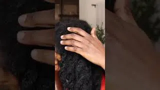 Thumbnail: Transform your hair with these kitchen ingredients! Very easy to make