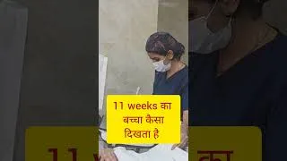 Thumbnail: 11 weeks ka baby 👶kaisa dikhta hai? #earlypregnancy #ntnbscan #viralvideo