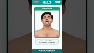 Thumbnail: Can You Diagnose This Neck Swelling? | Surgery Video Question | NEET PG 2026 #Shorts