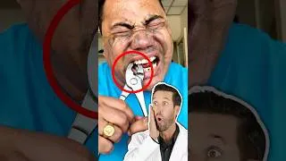 Thumbnail: ER Doctor REACTS to "Satisfying" Tooth Removal