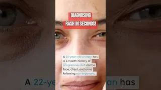 Thumbnail: Diagnosing rash in SECONDS! 👨🏻‍⚕️ .. #askdoctorhansen #ADH #doctormikehansen
