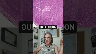 Thumbnail: Lymph Node