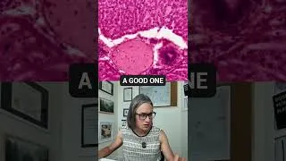 Thumbnail: Liver