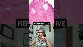 Thumbnail: Ovary
