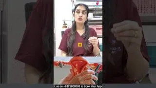 Thumbnail: PCOS/PCOD ka naam ab PMOS? 🤔 Kya sach mein badal gaya hai? #pcos #pcosinfertility #viral