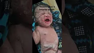 Thumbnail: Doctor 's day#newborn #delivery
