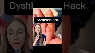 Thumbnail: The Hand Eczema Mistake to Stop Today #dermatologistadvice
