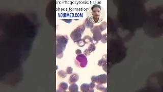 Thumbnail: Monocyte Identification - Hematology Lab