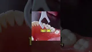 Thumbnail: You're Probably Flossing Your Teeth Wrong