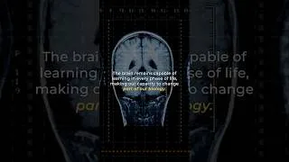 Thumbnail: Your Brain’s Capacity to Change | Dr Joe Dispenza