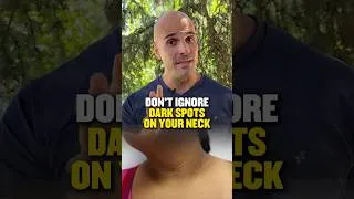 Thumbnail: Don't Ignore Dark Spots on Your Neck (Insulin Warning) #insulinresistance #metabolichealth