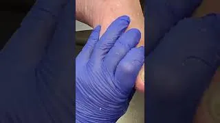 Thumbnail: The Most Satisfying Toenail Cleaning #shorts #satisfying #toenail